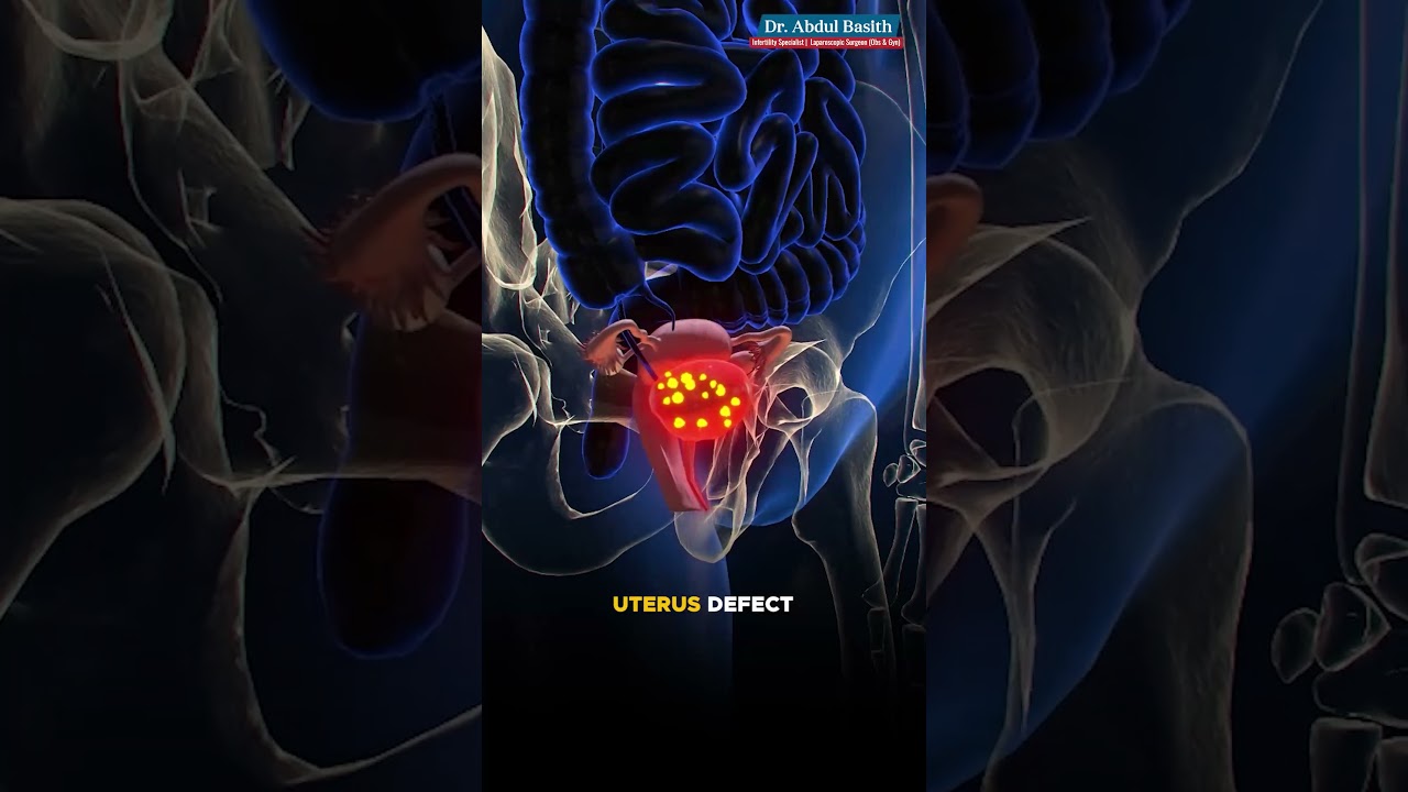 Video 1