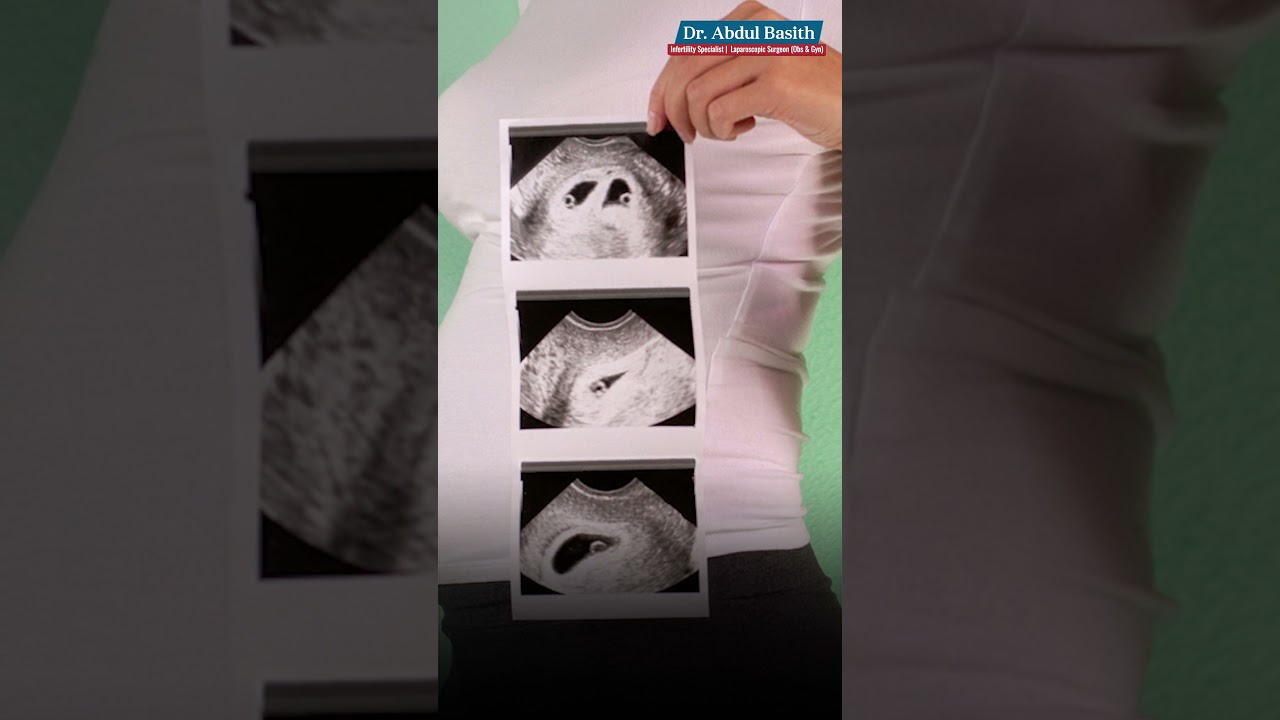 Video 1